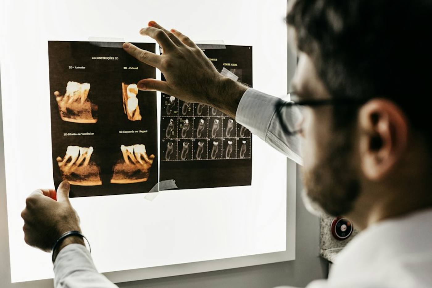 Dentista che osserva una radiografia